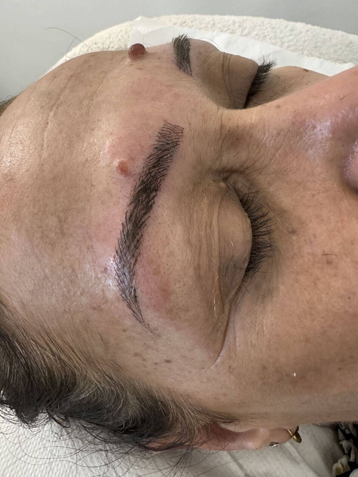 Microblading