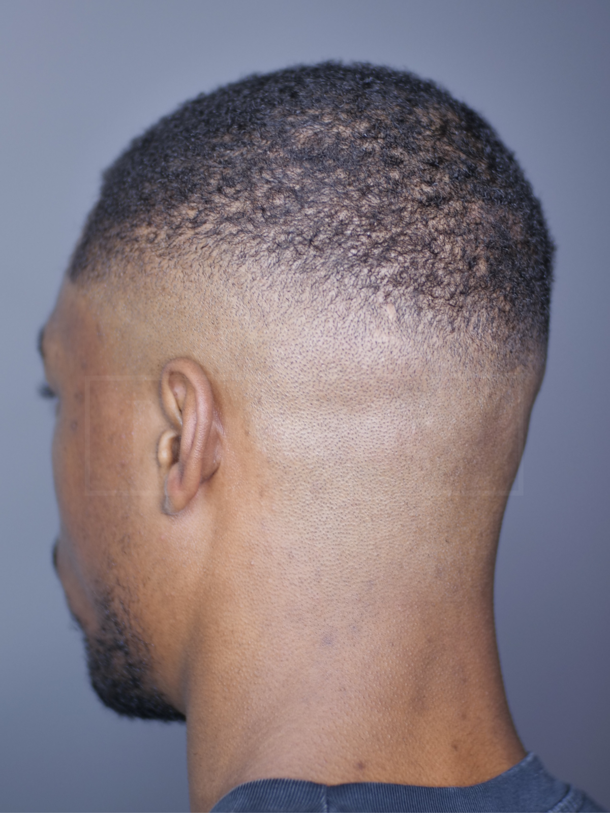 Style: High Skin Fade