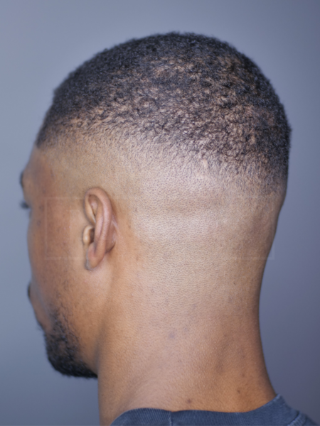 Style: High Skin Fade
