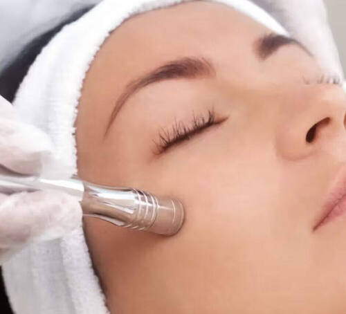 Microdermabrasion facial 