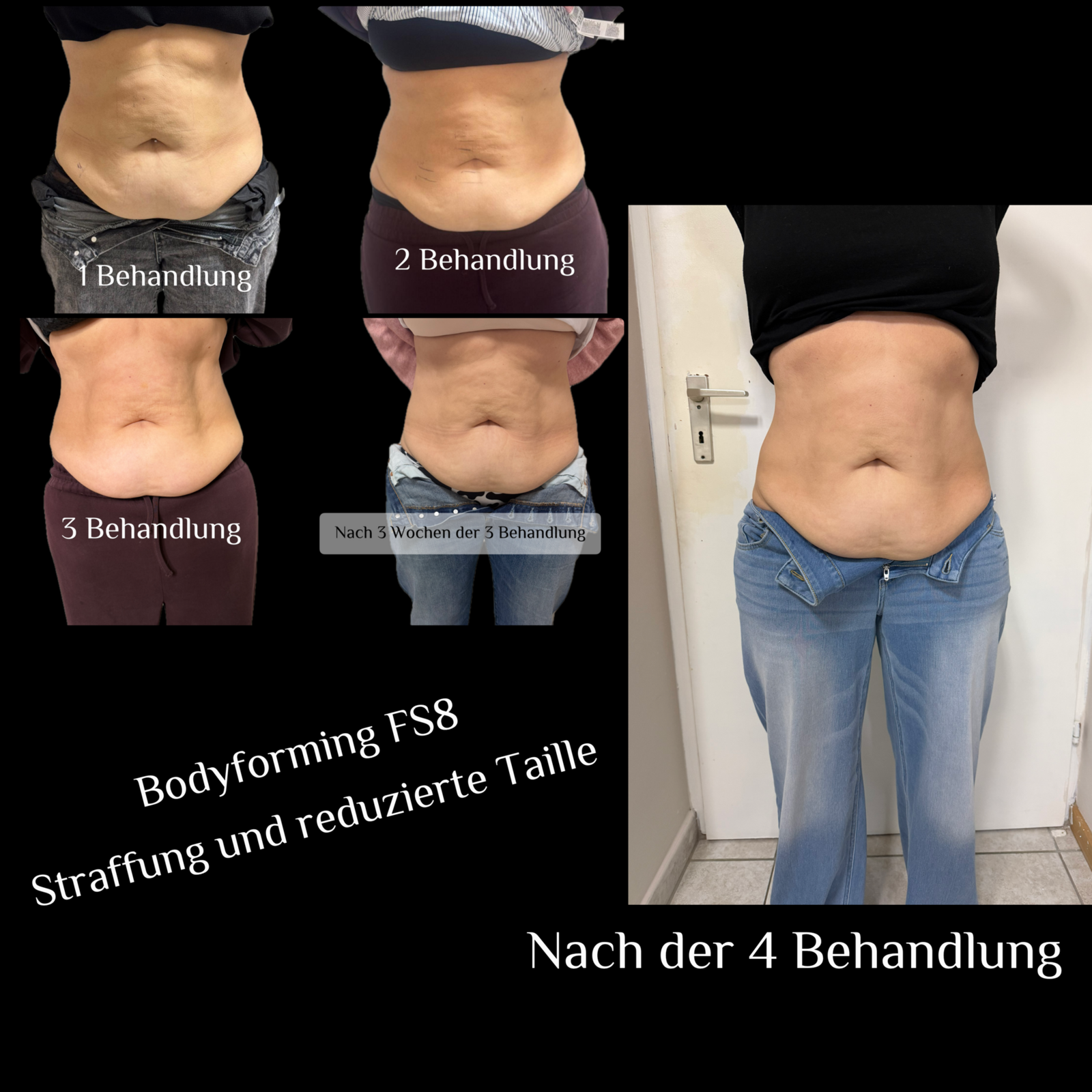 Bodyforming 3 er Behandlung Bauch 