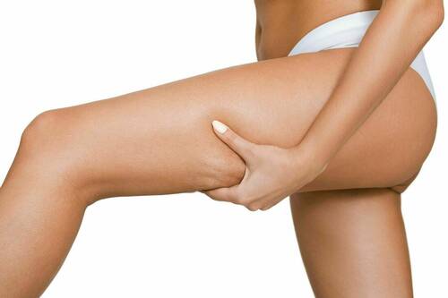 Anti Cellulite Bechandlungen 