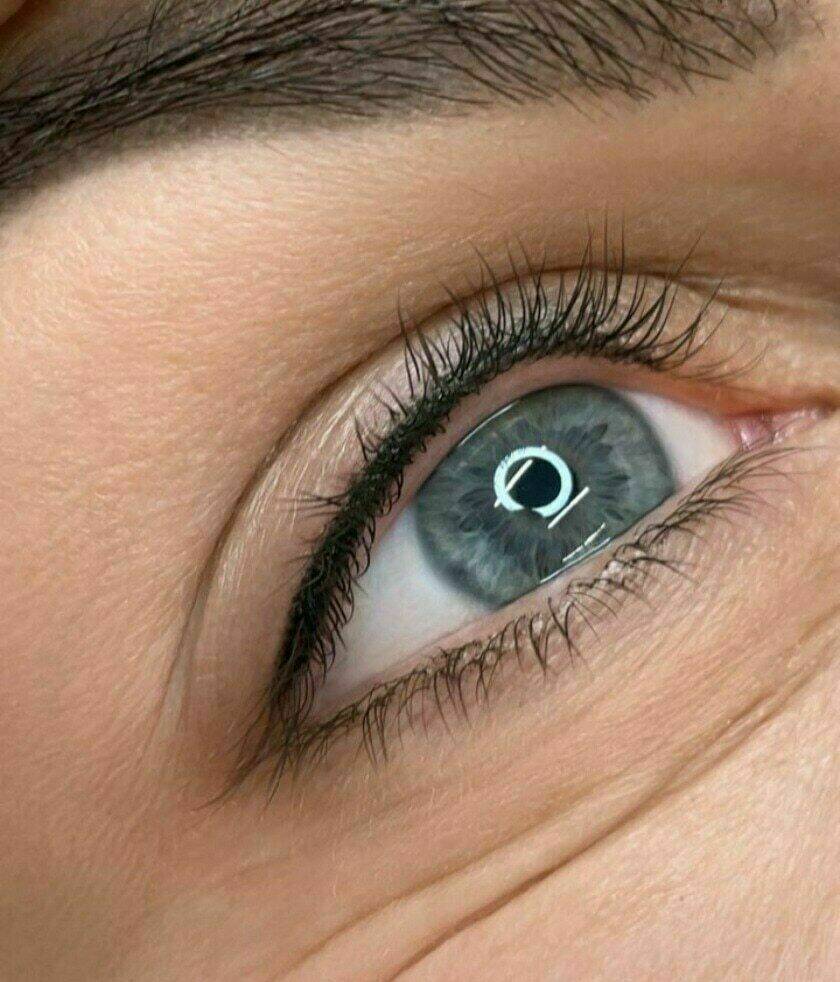 Wimpernkranz gleich nach der Pigmentierung 