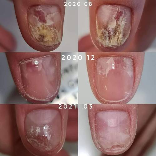 Clearance Solutions drops