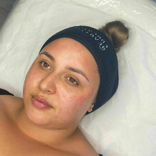 Clear skin treatment, involving an extraction based facial and chemical peel. It works really well to clear congestion and slow down oil production. 