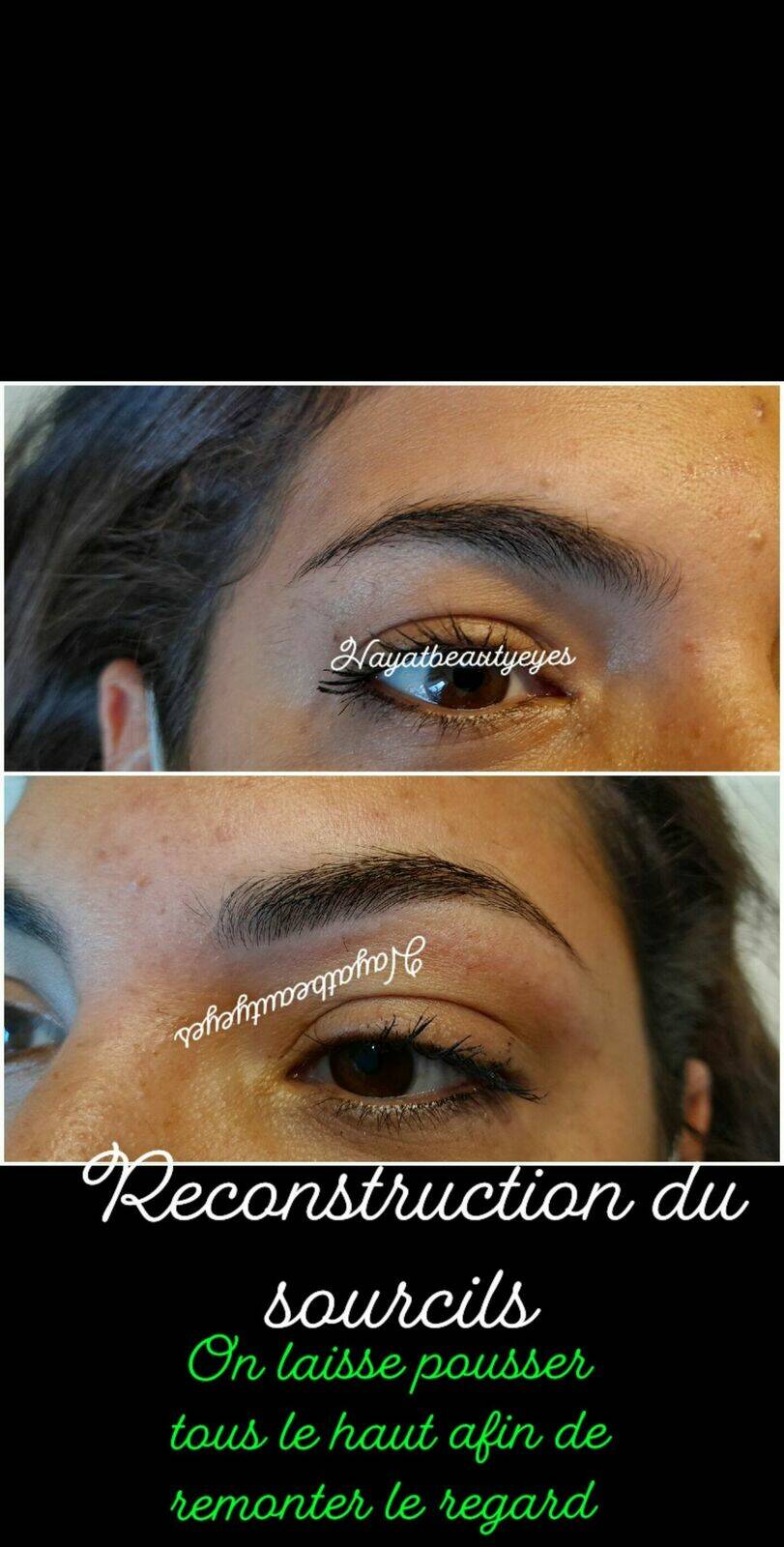 Reconstruction sourcils 