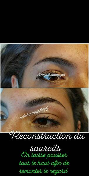 Reconstruction sourcils 