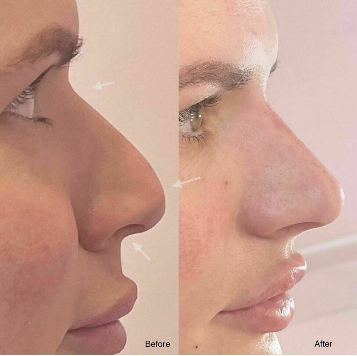 Louise/bbskin clinic/blush brow studio