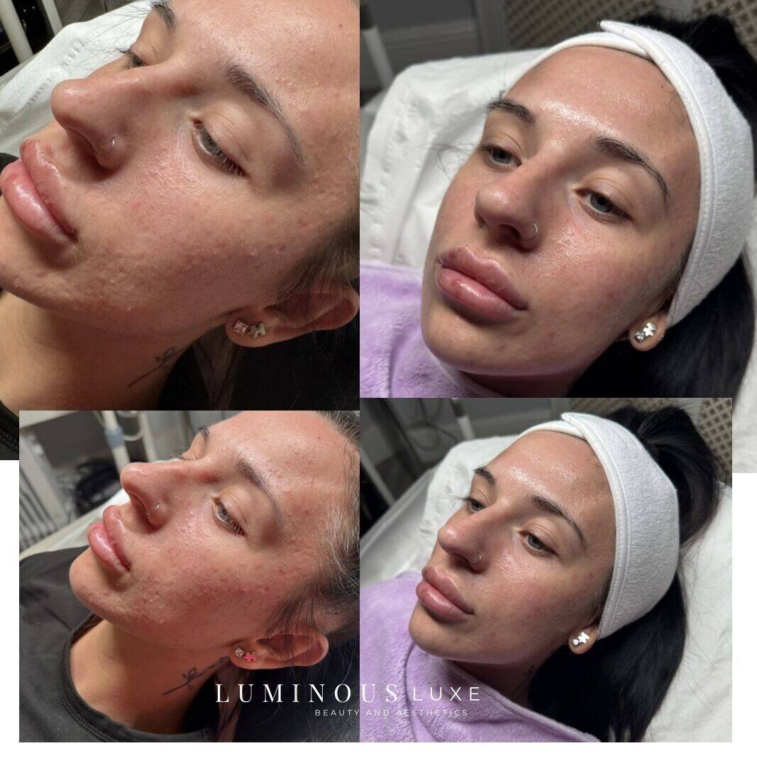 ✨ THAT REGULAR FACIAL GLOW ✨ Achieve that fresh, luminous glow with our signature facial treatments — designed to nourish, hydrate, and bring out your natural radiance.