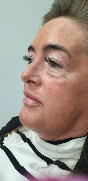 Lip booster & skin face boosters