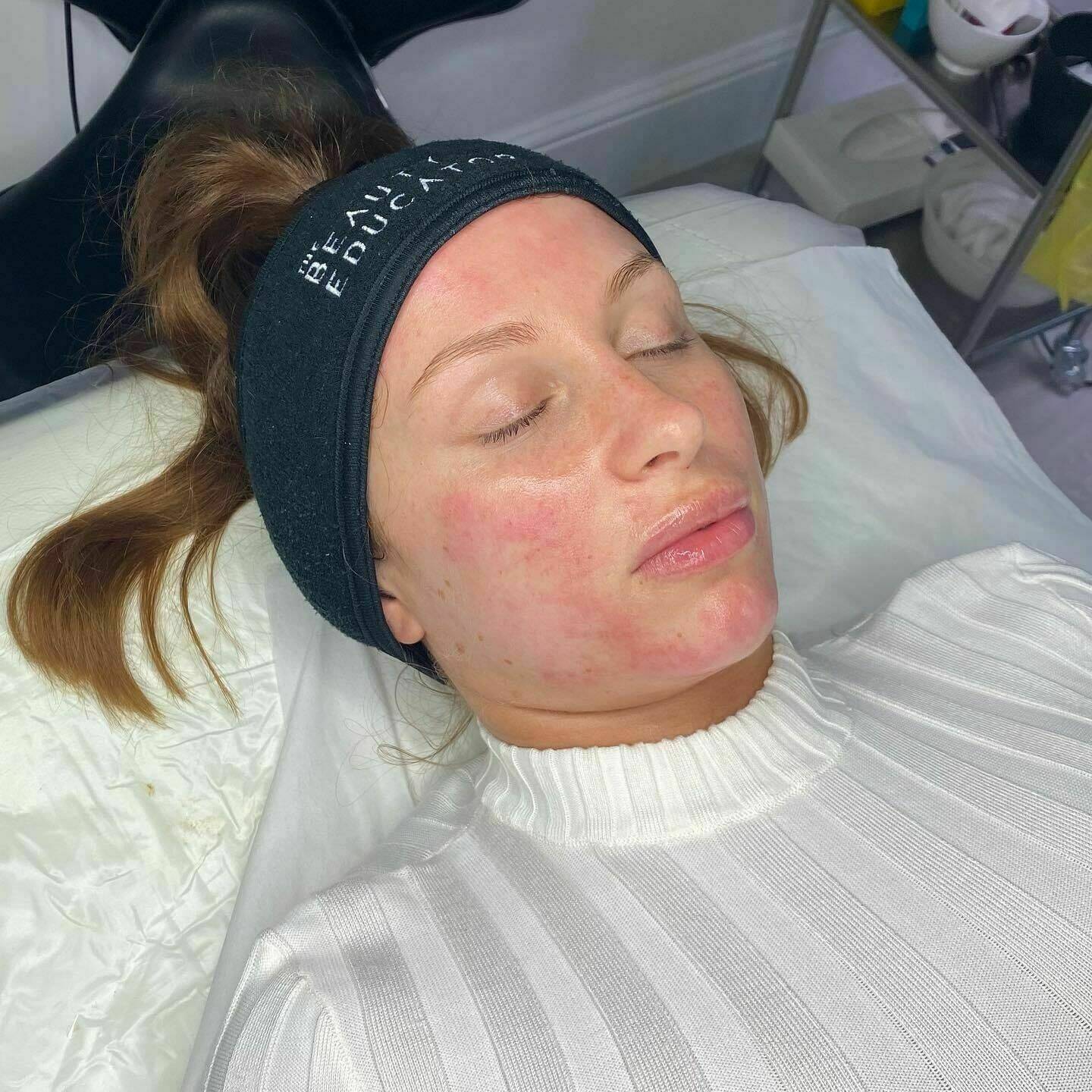The Ultimate Glow Up, including extraction, chemical peel, dermaplaning, dermaroller and various medically graded products to achieve the ‘Ultimate Glow’ 