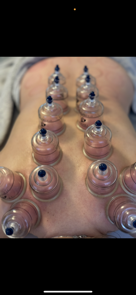 Dry cupping 
