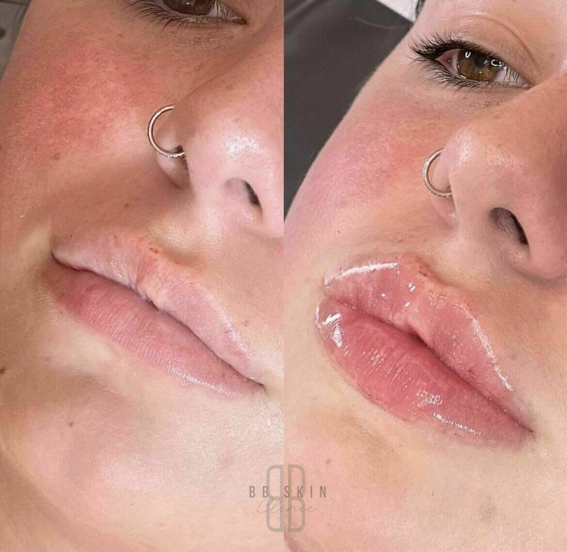 Louise/bbskin clinic/blush brow studio