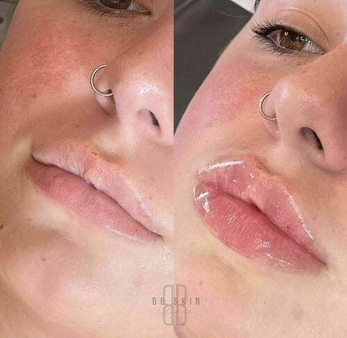 Louise/bbskin clinic/blush brow studio