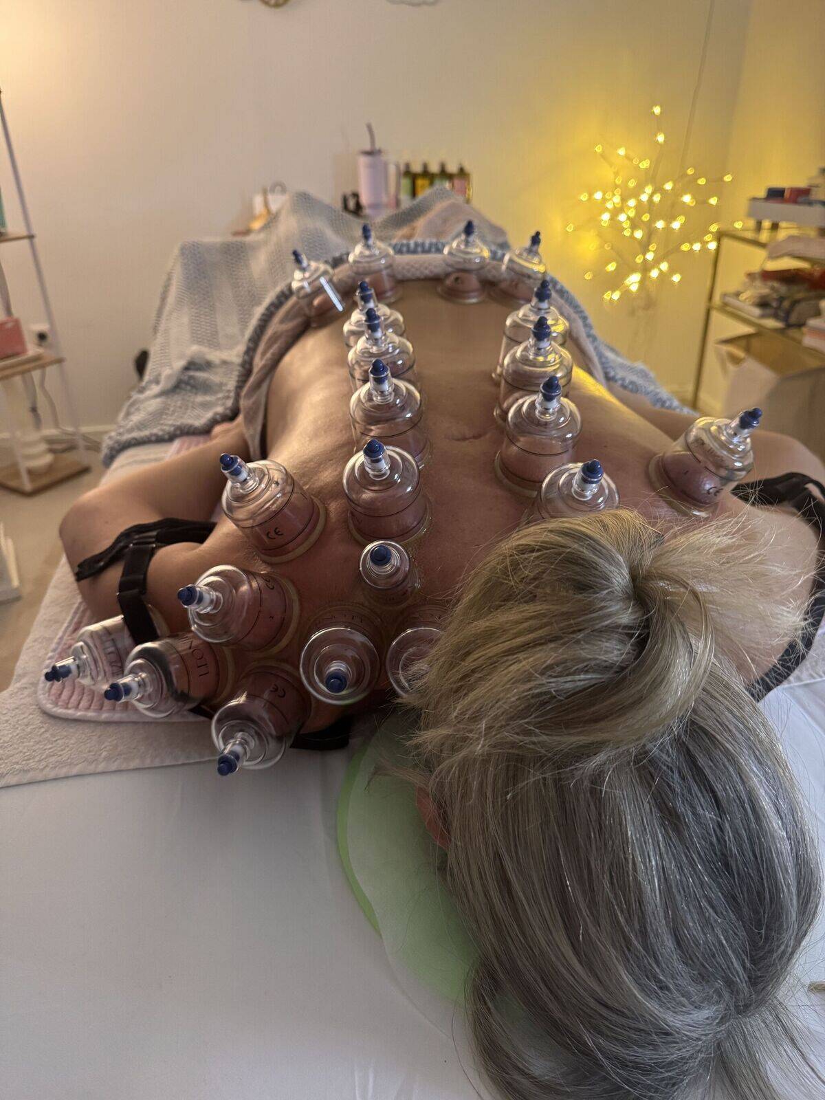 Rückenmassage mit Schröpfen