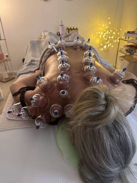 Rückenmassage mit Schröpfen