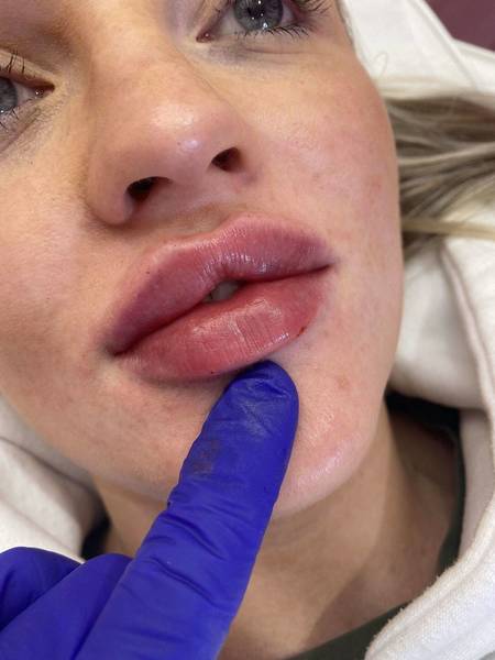 Rᴜssɪᴀɴ ᴠᴇʟᴠᴇᴛ 1.1ML