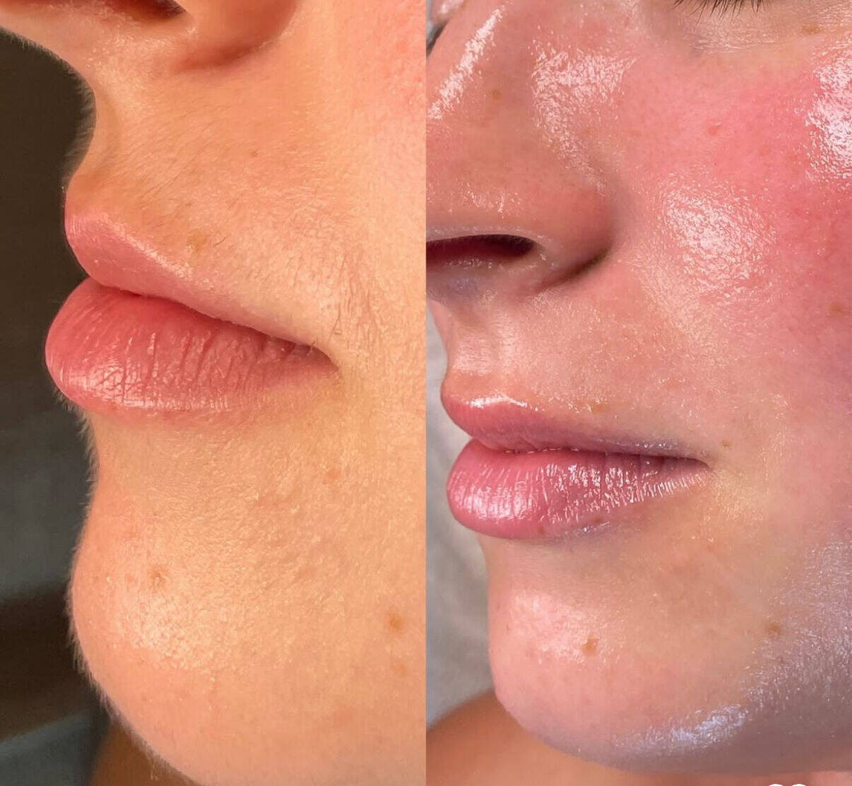 Velvet Dermaplane Facial