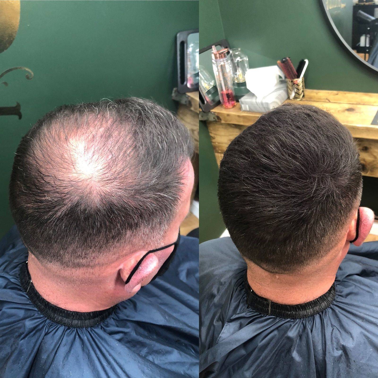 Results from hair fibres