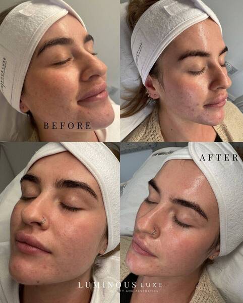 Clear skin starts here! Say goodbye to clogged pores and hello to a smoother, glowing complexion! 🧖🏼‍♀️