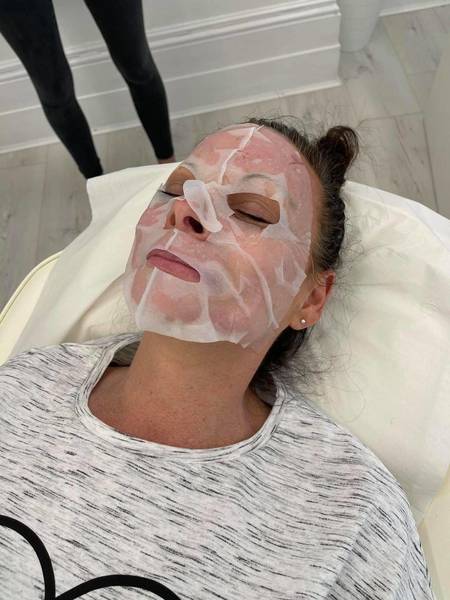 Microneedling Training Day 