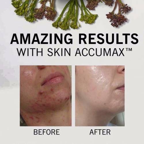 Advanced Nutrition Programme 