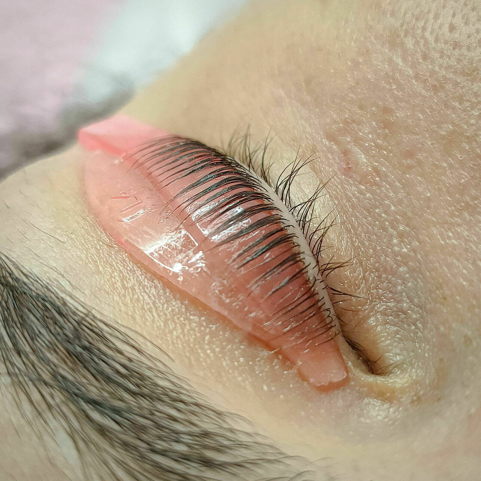 Technique de rehaussement