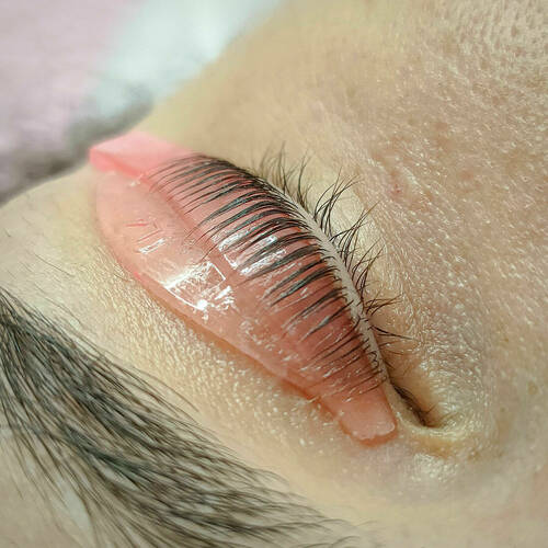 Technique de rehaussement