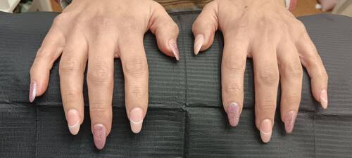 Babyboomer und Glitzer