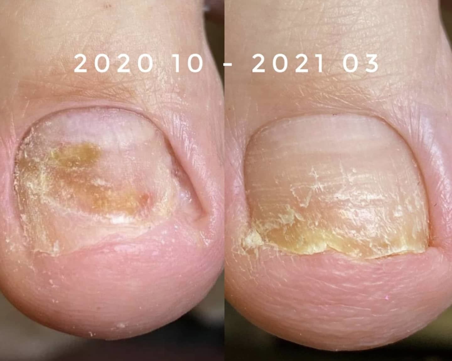 Clearance Solutions drops