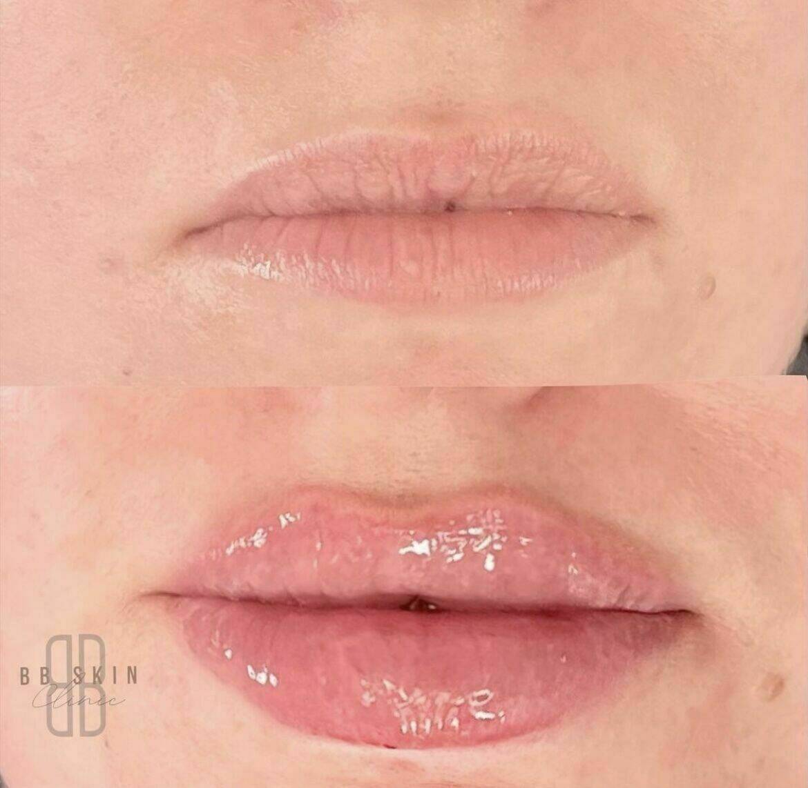 Louise/bbskin clinic/blush brow studio