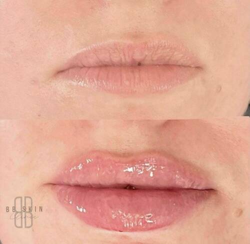 Louise/bbskin clinic/blush brow studio