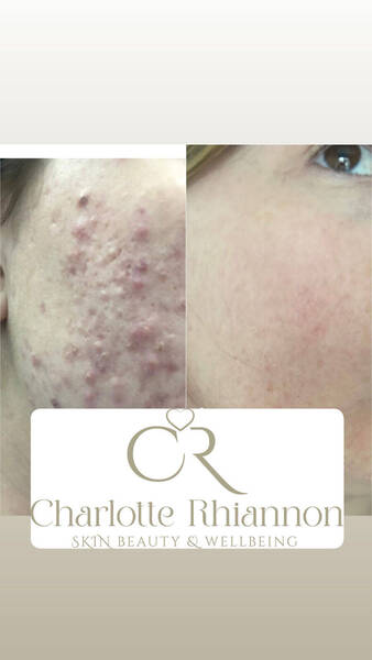 Charlotte Rhiannon Skin, Beauty & Well-Being