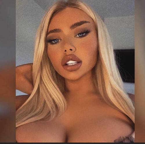 Client Selfie 1.1ml Lip Enhancement 