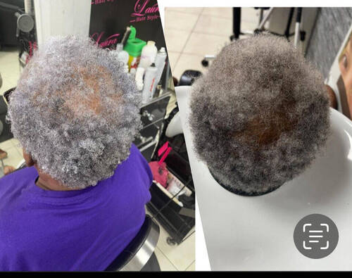 Forfait cure Anti chute VELLO YBERA femme