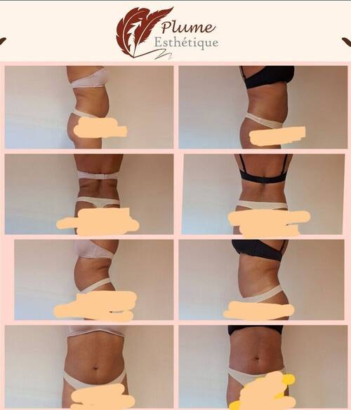 Avant /Après MINCEUR