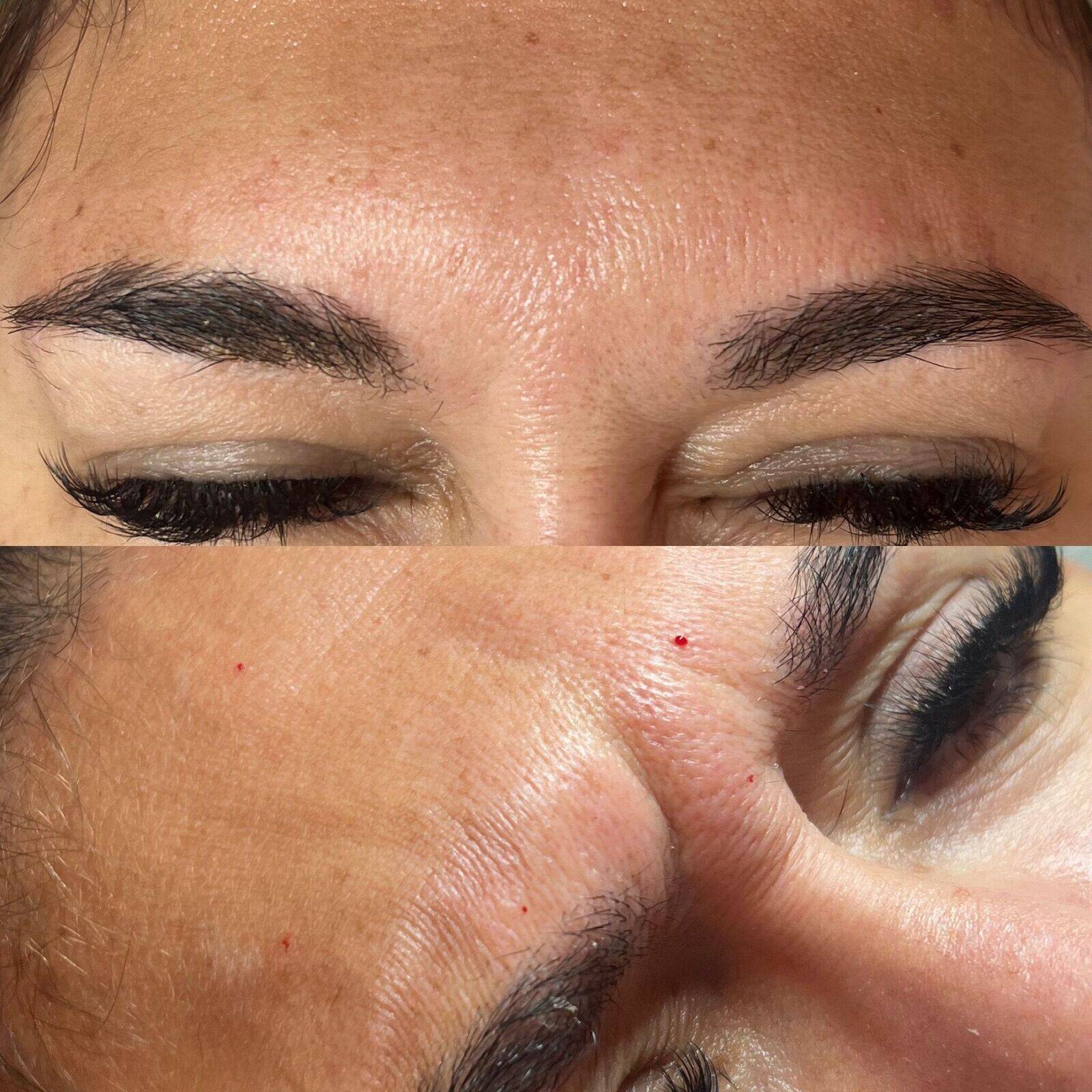 Bottom (Before) & Top (After)