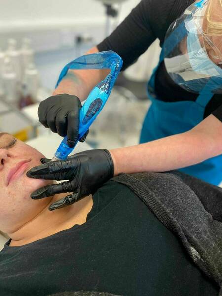 Microneedling Rapid focusing on collagen production and combating any textural issues. 