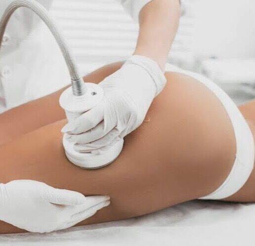 Abonnement lipocavitation jambes