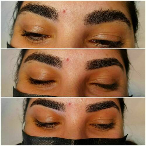 Reconstruction sourcils 