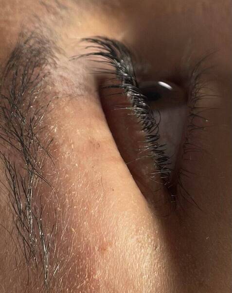 Lash lift 