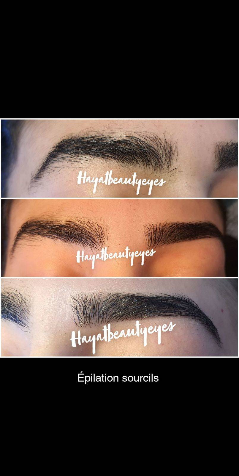 Reconstruction sourcils 