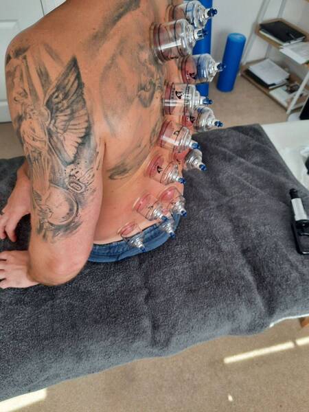 Sports massage with dry cupping 