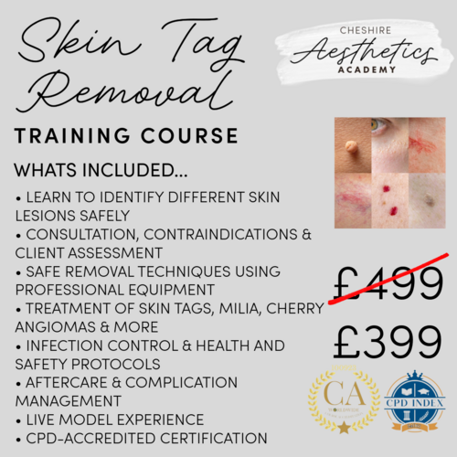 Skin Tag Removal Training