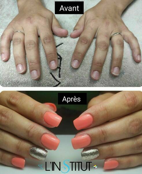 Avant / Après pose capsules Américaine 