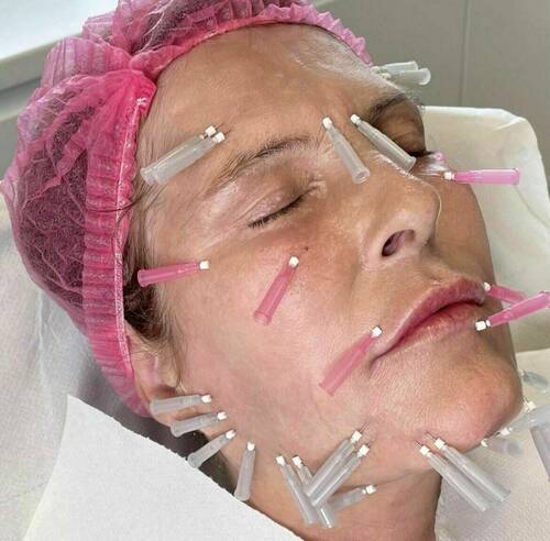 Louise/bbskin clinic