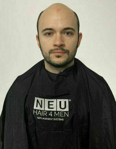 Before a hair system 