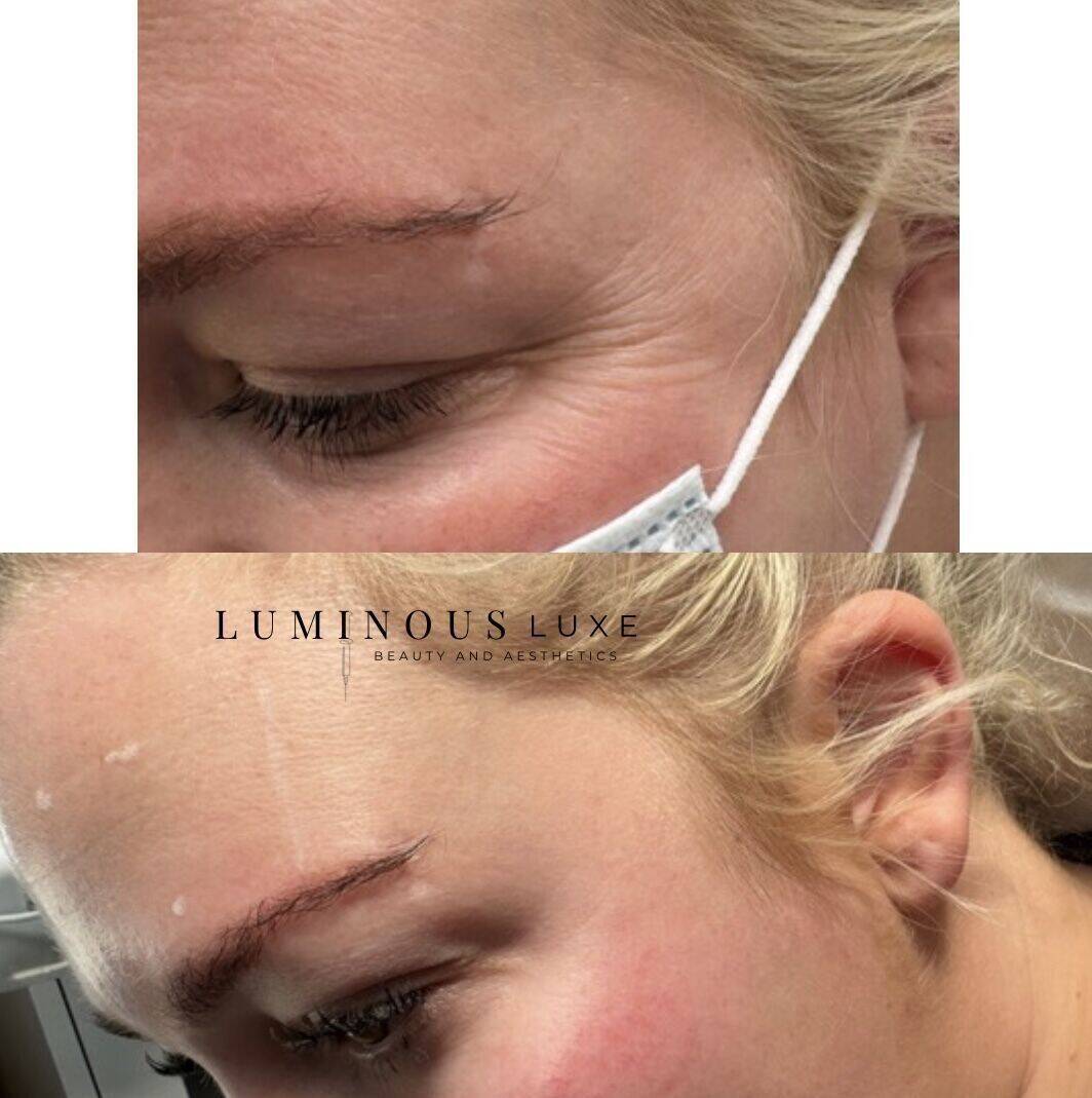 Nothing a little botox won't fix!