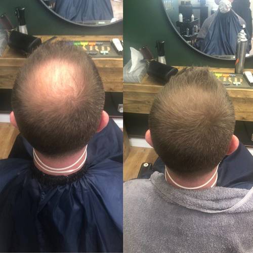 Results from hair fibres