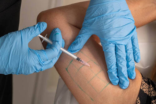 Fat dissolve injections 
